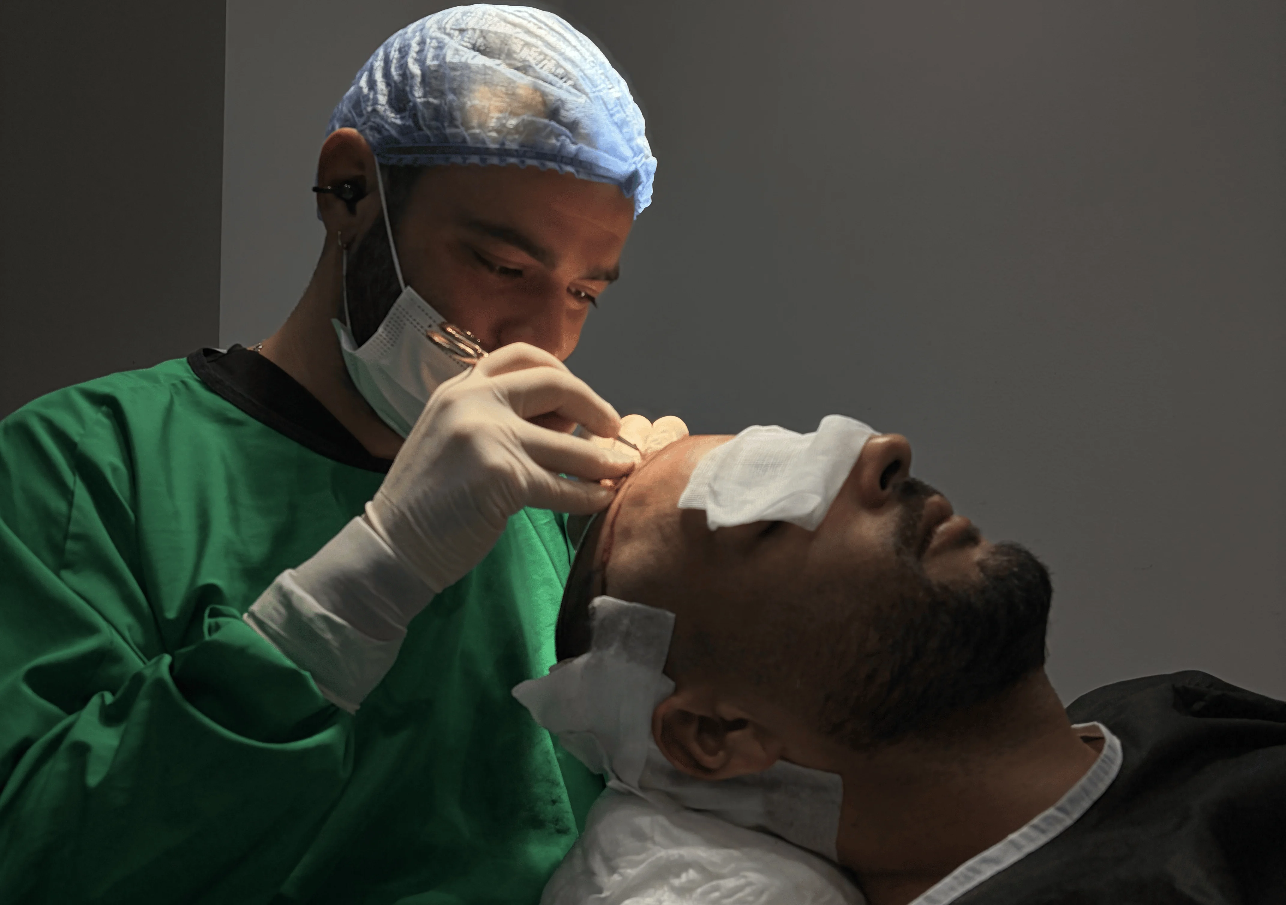 Chirurgien en train d’extraire des follicules pileux avec un micro-punch lors d’une greffe FUE, sous éclairage opératoire.